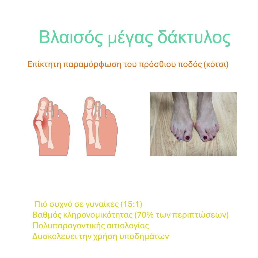 Απεικόνιση βλαισού μεγάλου δακτύλου